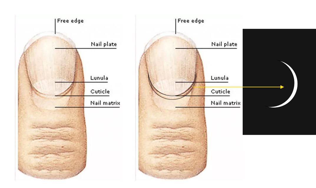 Лунула. Ноготь кутикула лунула. Большая лунула на ногте большого пальца. Лунула неправильной формы на ногтях.